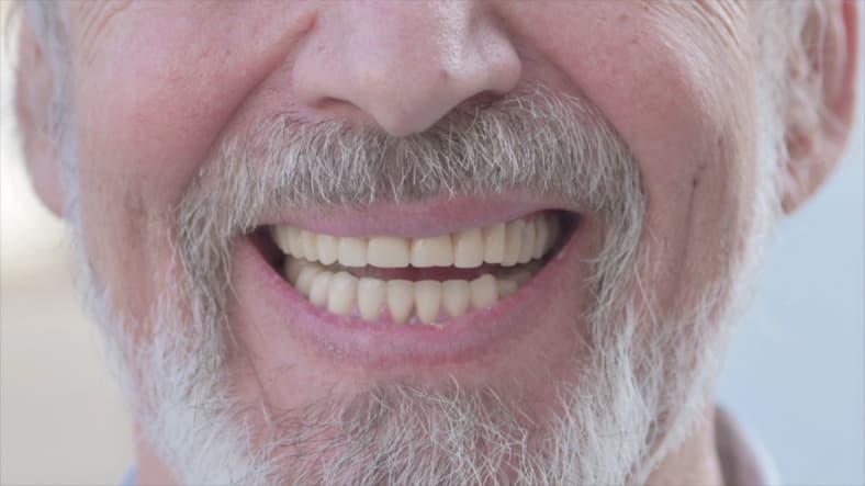 Pasient med tannprotese i Oslo smiler trygt etter behandling hos Sanner Tannklinikk