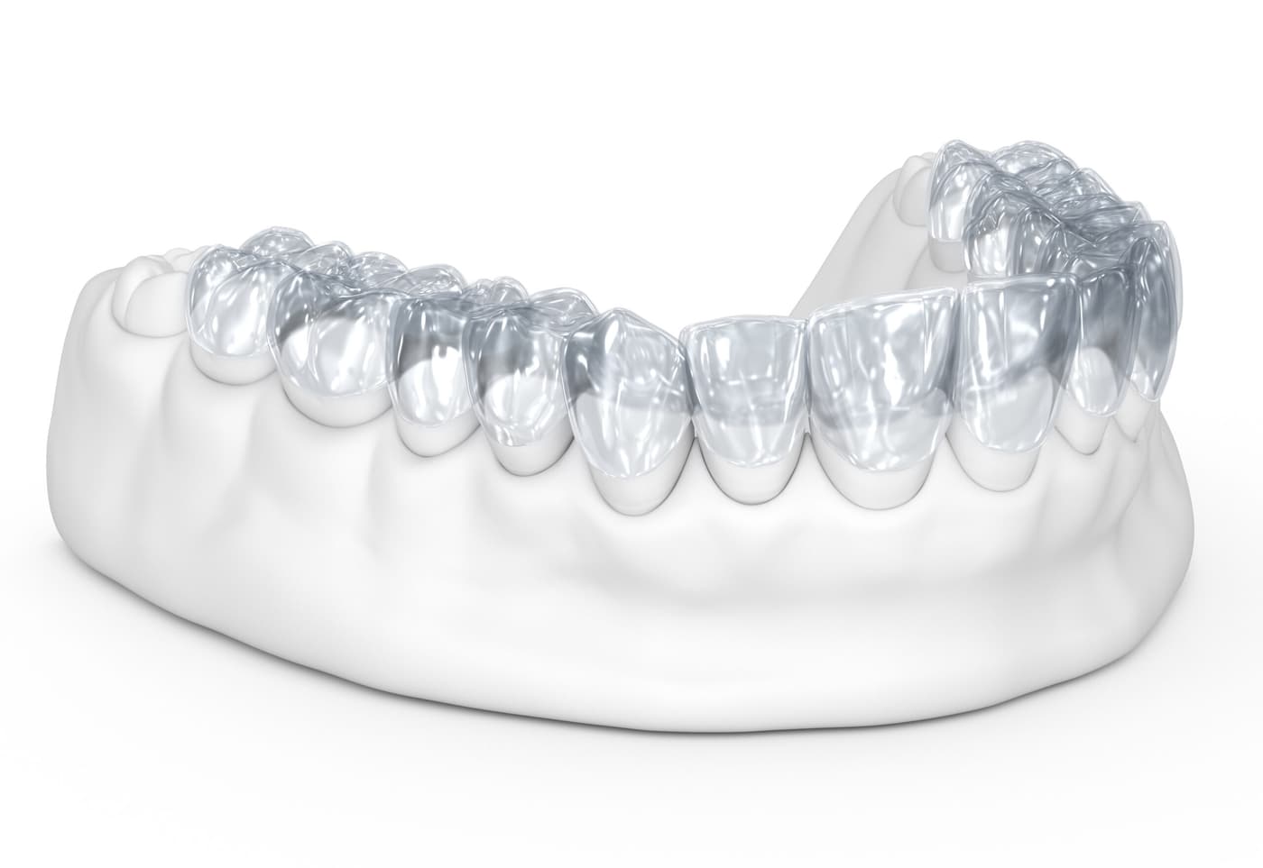 Gjennomsiktig aligner for usynlig tannregulering